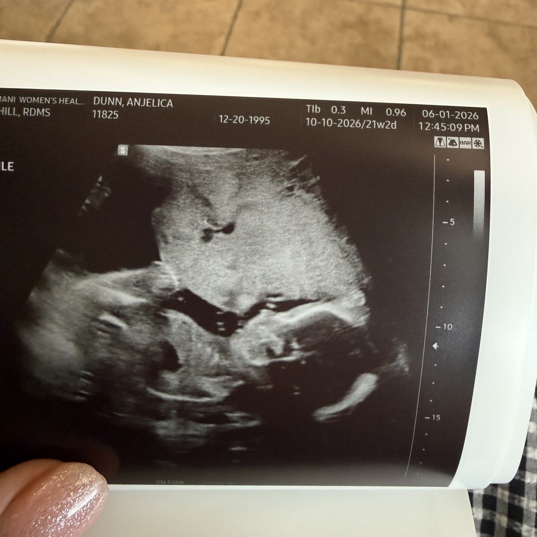 Photo shared by Anjelica for their Babylist baby registry.