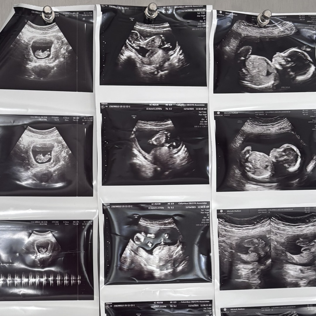 Photo shared by Madison for their Babylist baby registry.