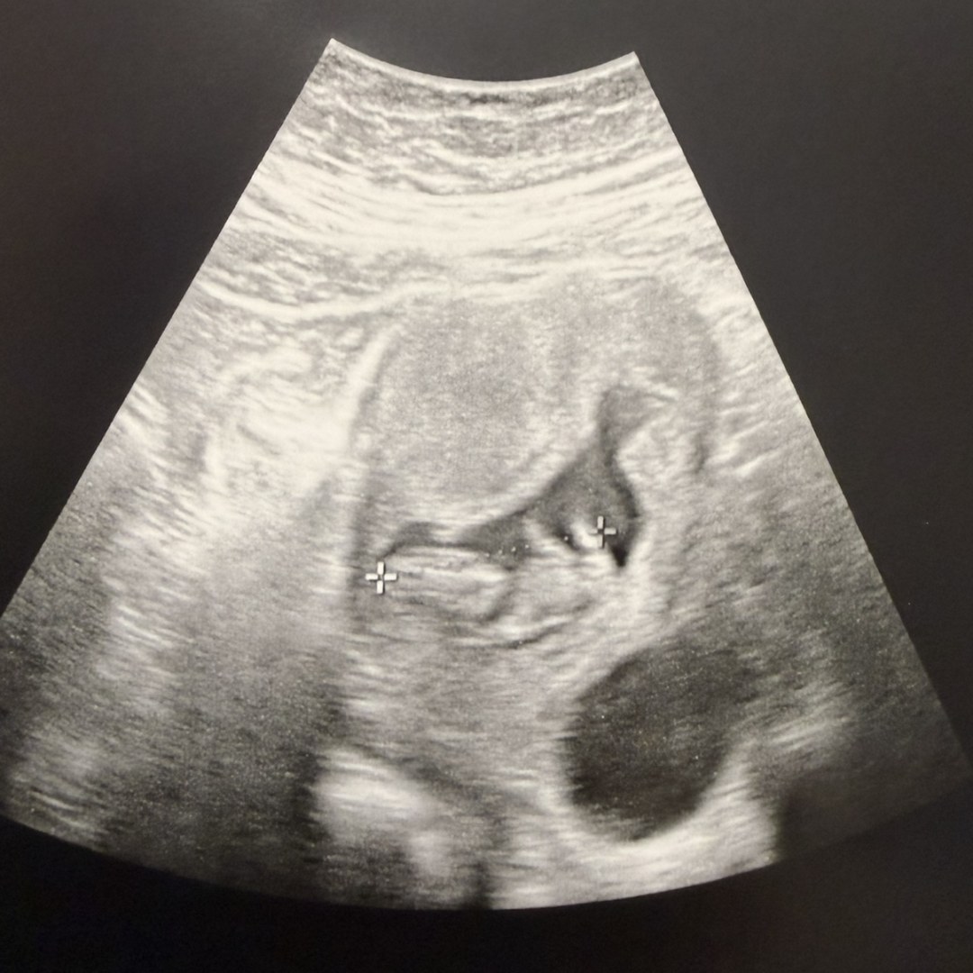 Photo shared by Megan for their Babylist baby registry.