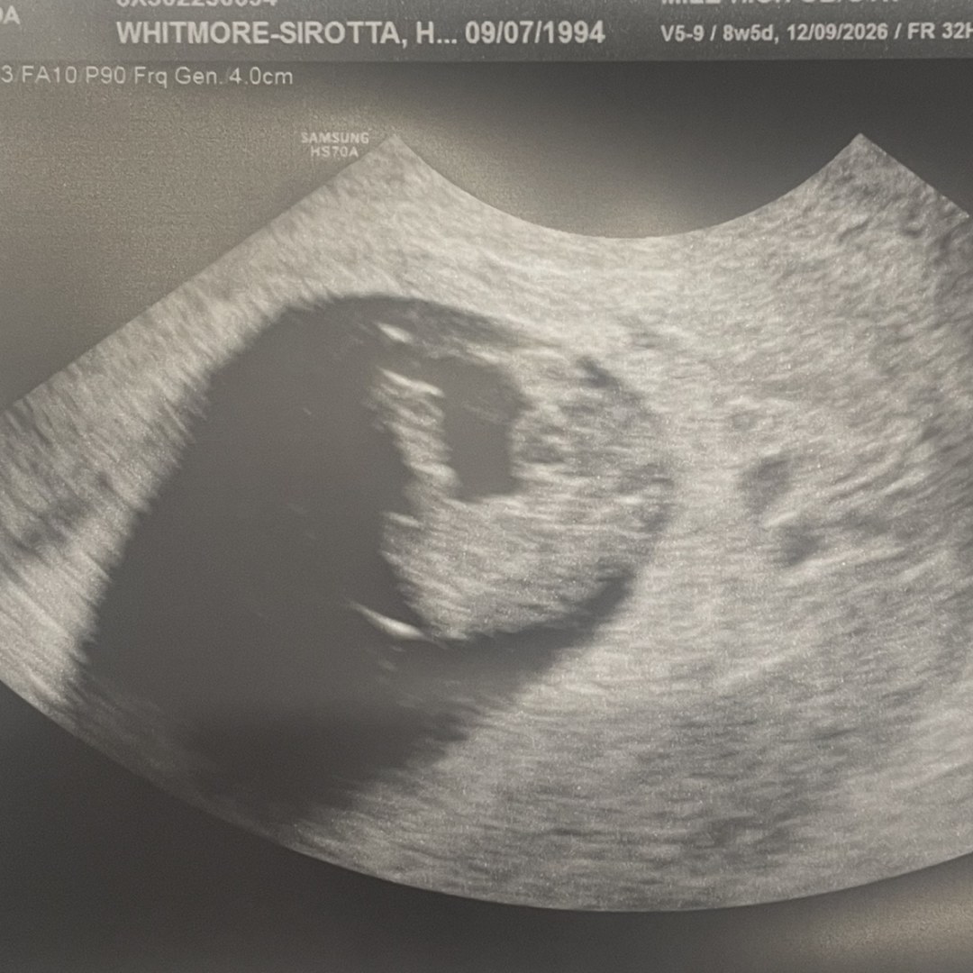 Photo shared by Rosie for their Babylist baby registry.