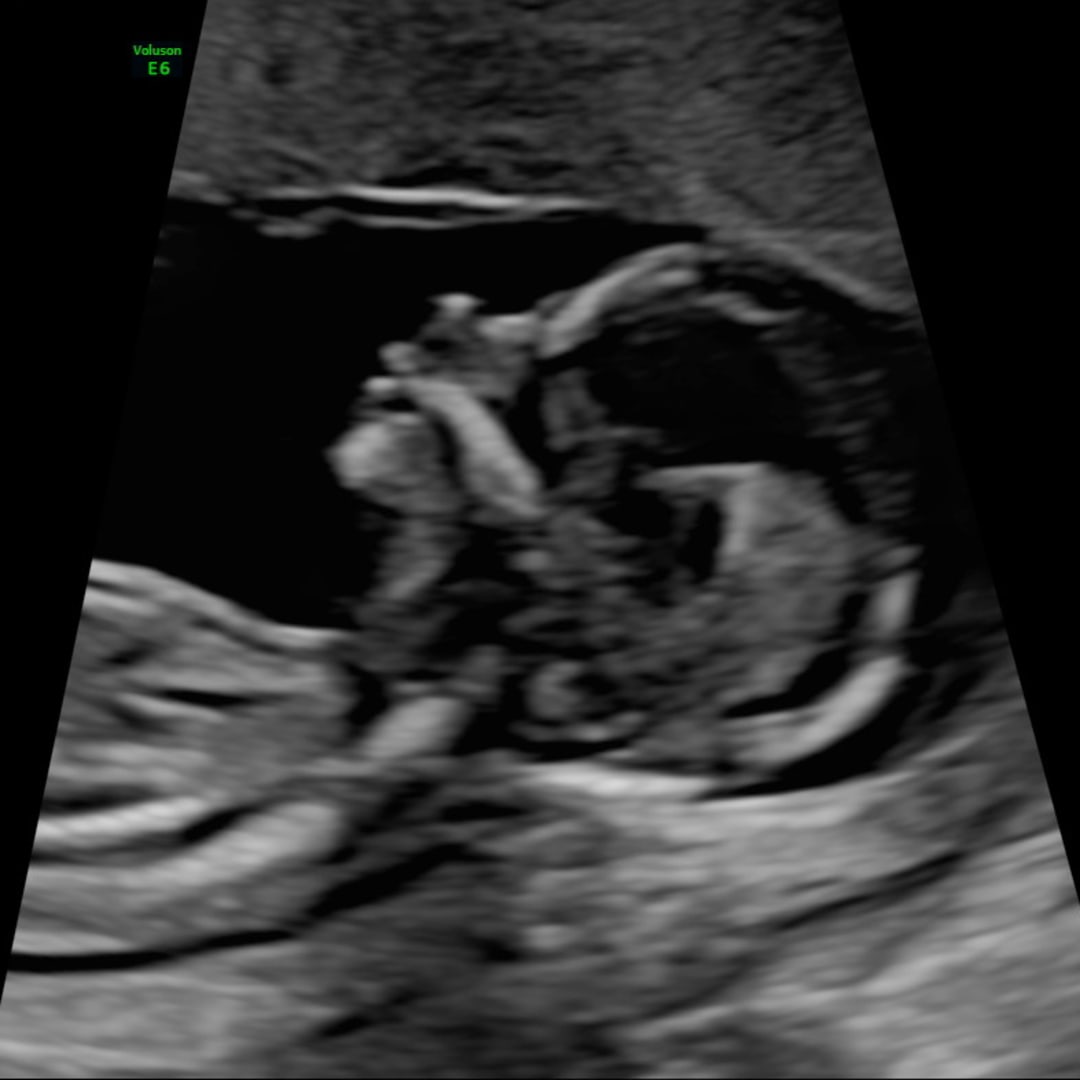 Photo shared by Eva for their Babylist baby registry.