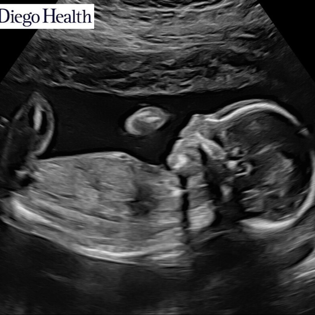 Photo shared by Molly for their Babylist baby registry.