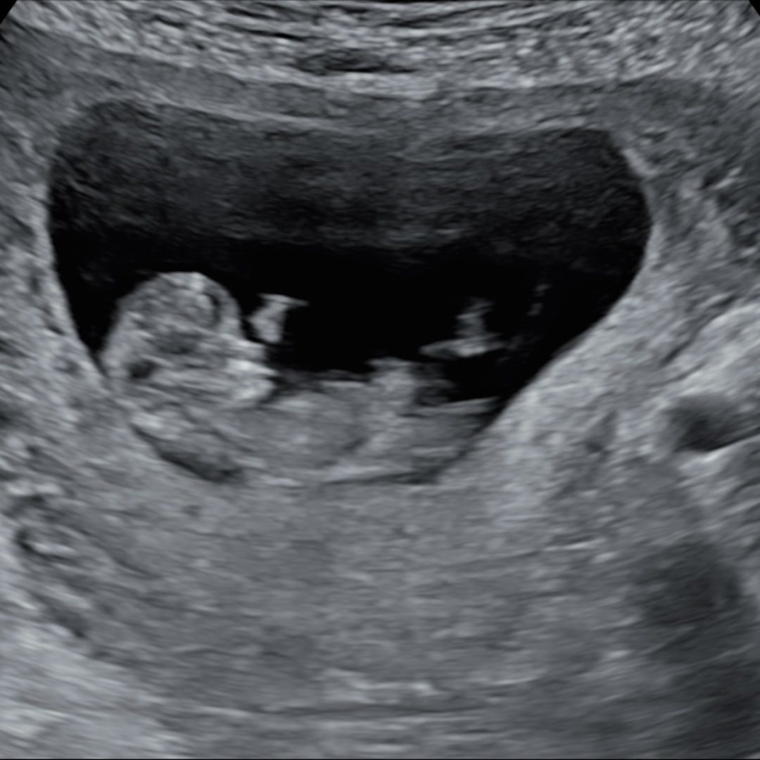 Photo shared by Riley for their Babylist baby registry.
