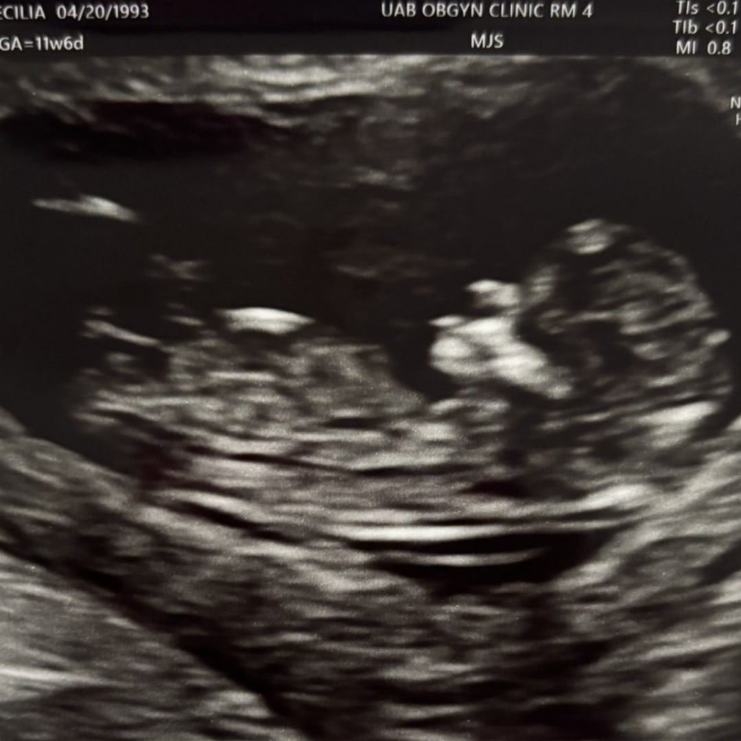 Photo shared by Cecilia for their Babylist baby registry.