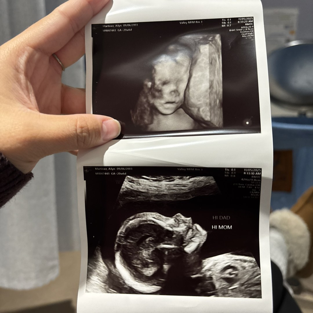 Photo shared by Ailyn for their Babylist baby registry.