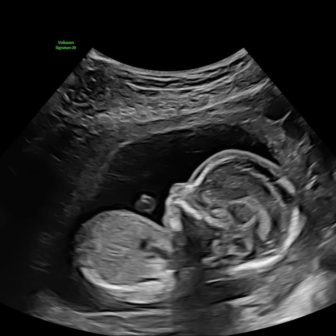 Photo shared by Casey for their Babylist baby registry.
