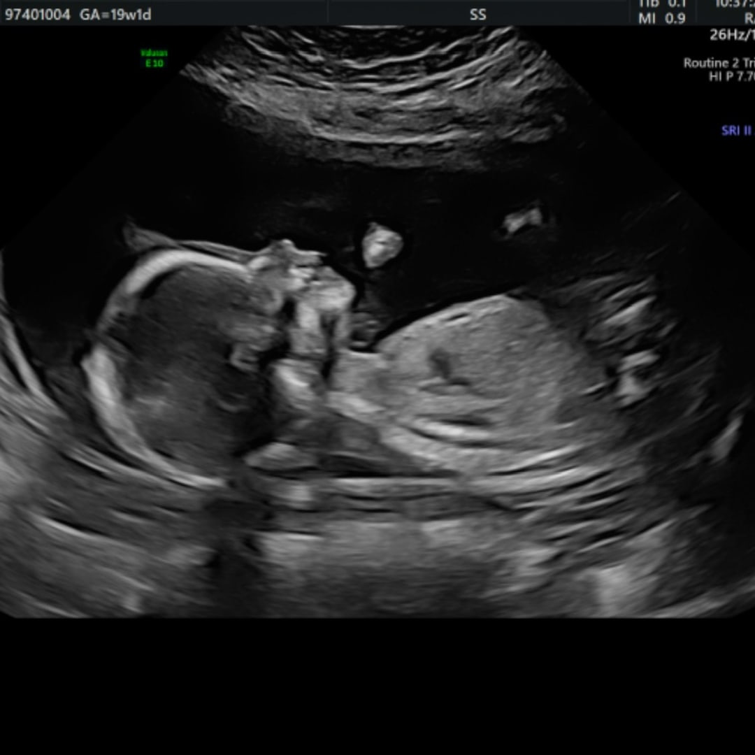 Photo shared by Samantha for their Babylist baby registry.