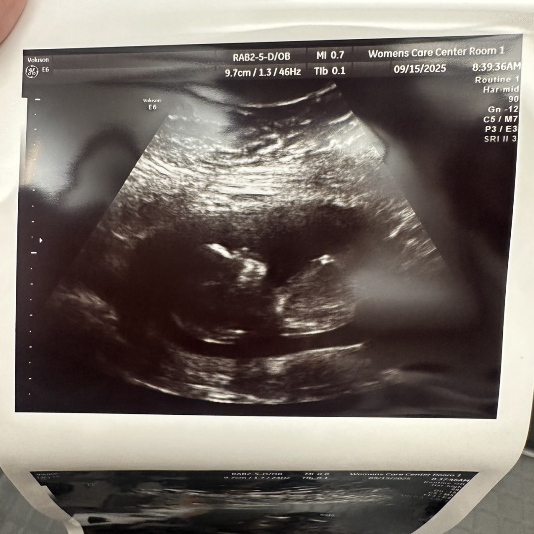 Photo shared by Alexandrea Quinn for their Babylist baby registry.