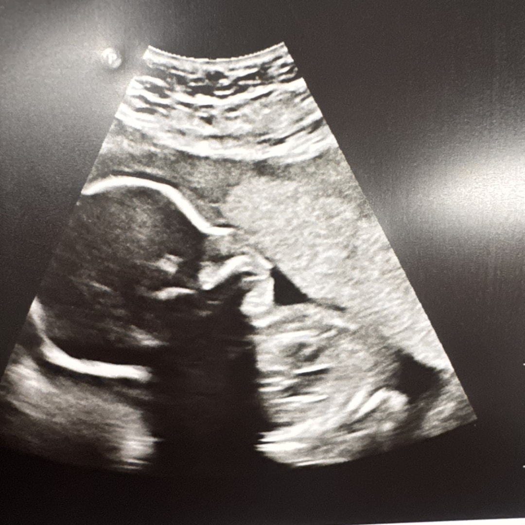 Photo shared by Kimberly for their Babylist baby registry.