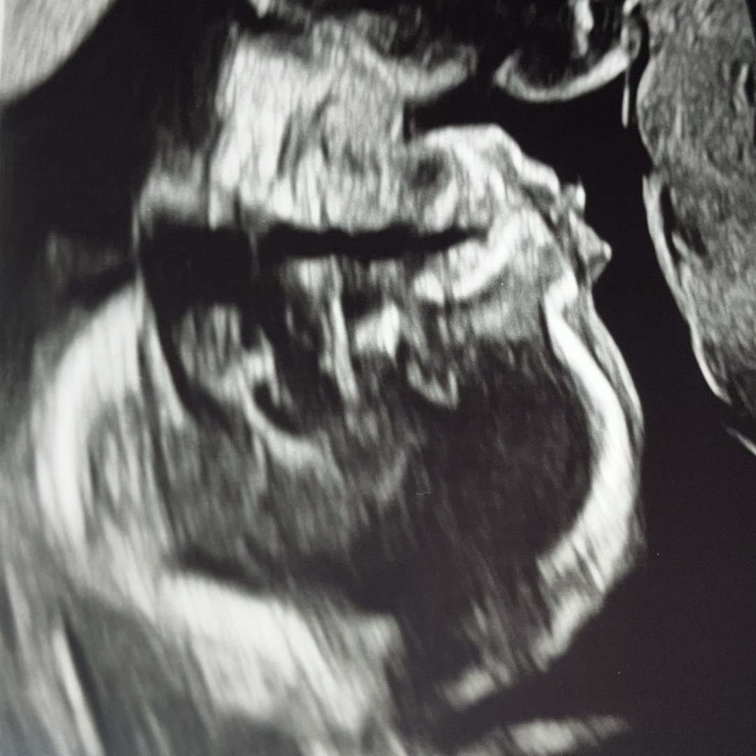 Photo shared by Suhnovian for their Babylist baby registry.