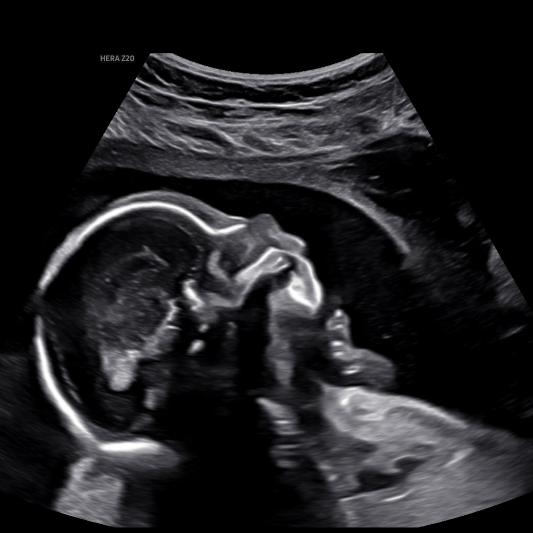 Photo shared by Amanda for their Babylist baby registry.