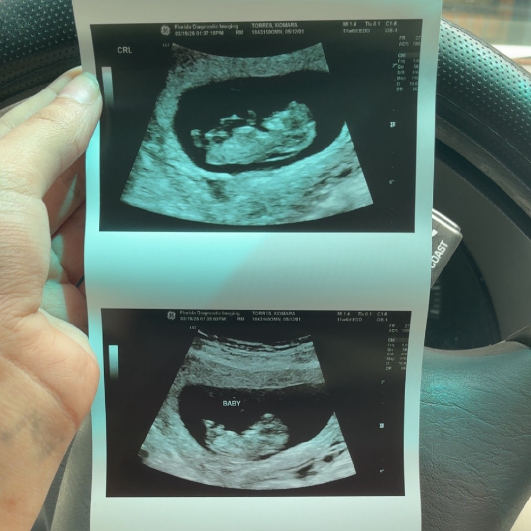 Photo shared by Xiomara for their Babylist baby registry.