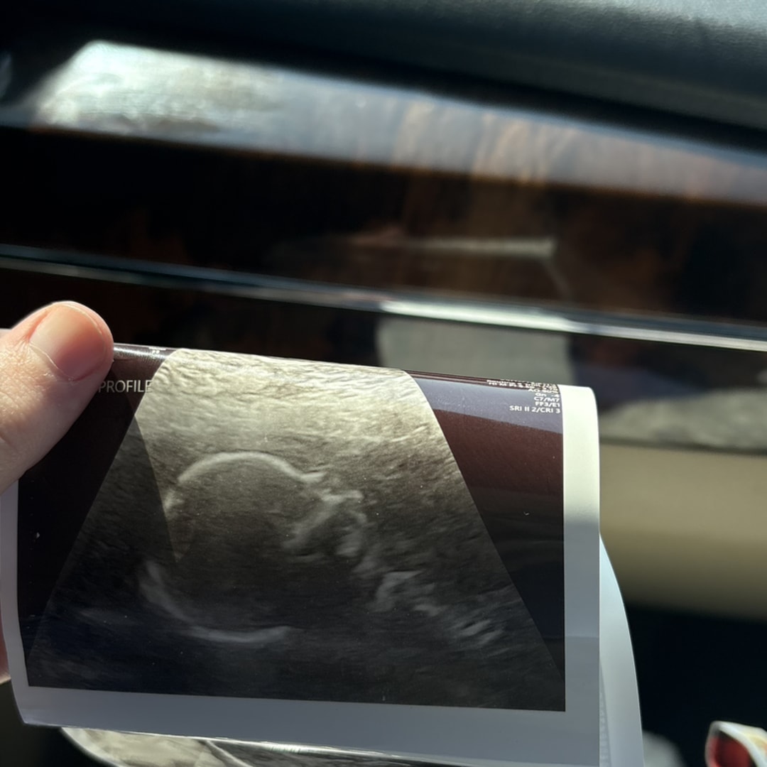 Photo shared by Taylor for their Babylist baby registry.