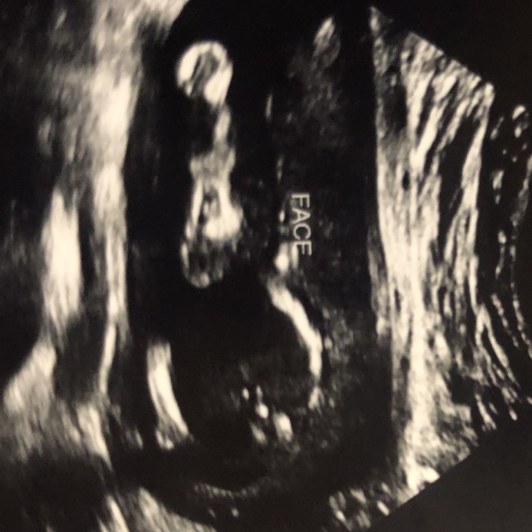 Photo shared by Aubree for their Babylist baby registry.