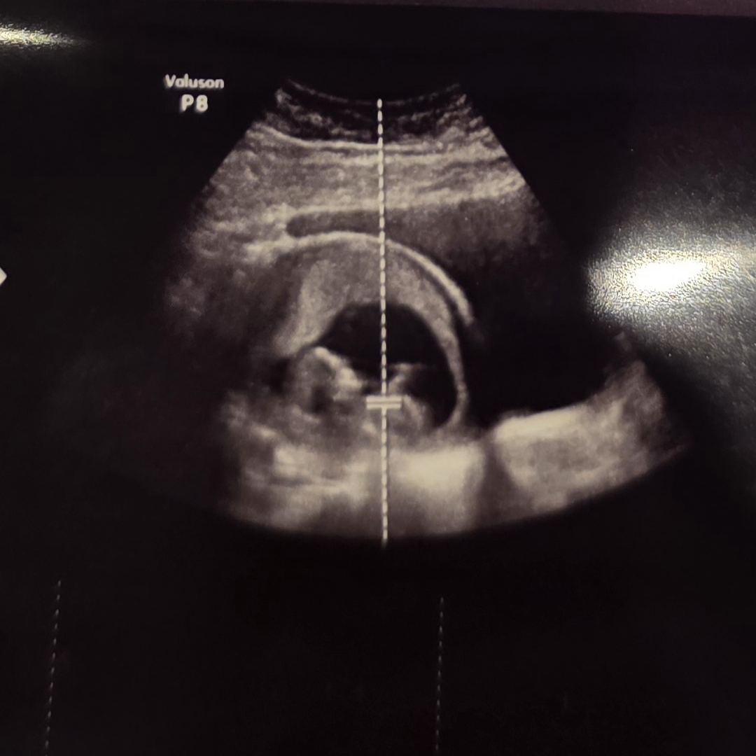Photo shared by Erin for their Babylist baby registry.
