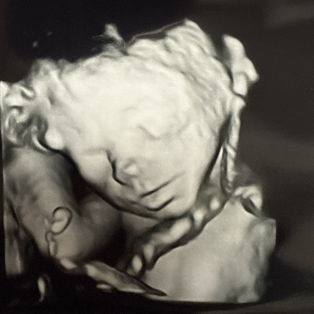 Photo shared by Neleigh for their Babylist baby registry.