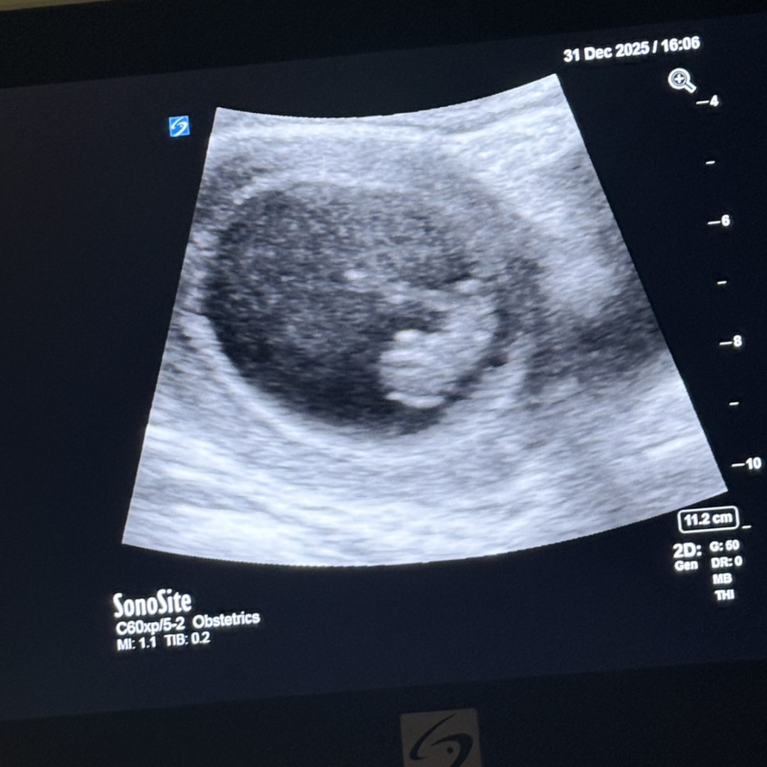 Photo shared by Savannah for their Babylist baby registry.