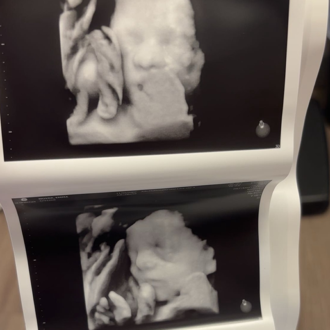 Photo shared by Emma for their Babylist baby registry.