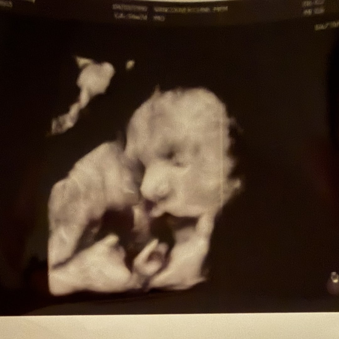 Photo shared by Ashley for their Babylist baby registry.