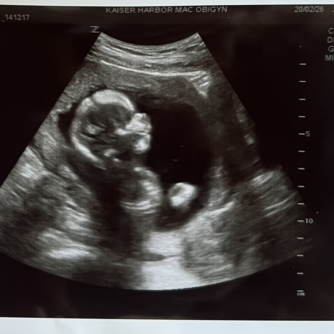 Photo shared by Sam for their Babylist baby registry.