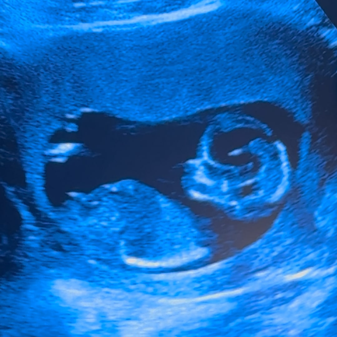 Photo shared by Jenn for their Babylist baby registry.