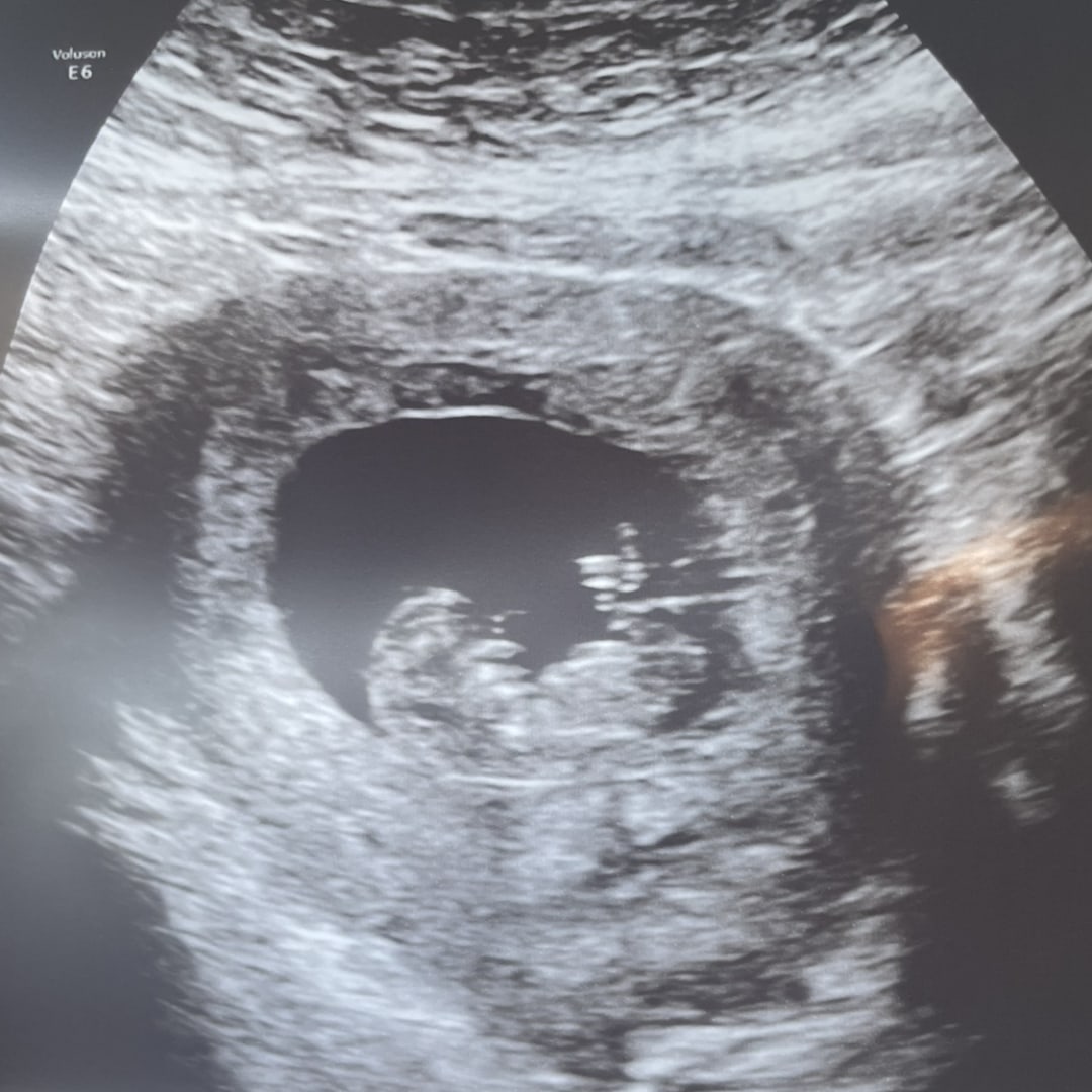 Photo shared by Melissa for their Babylist baby registry.