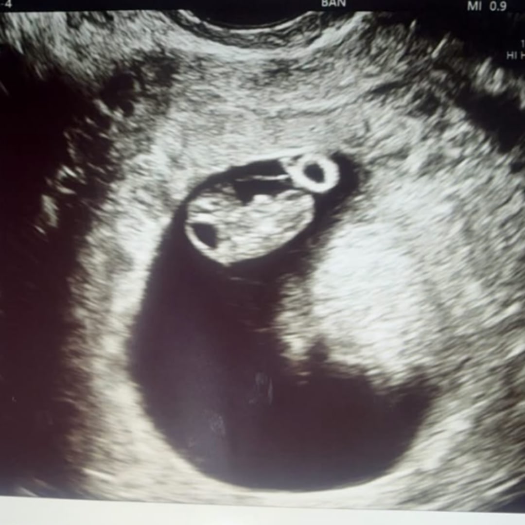 Photo shared by Alexandria for their Babylist baby registry.