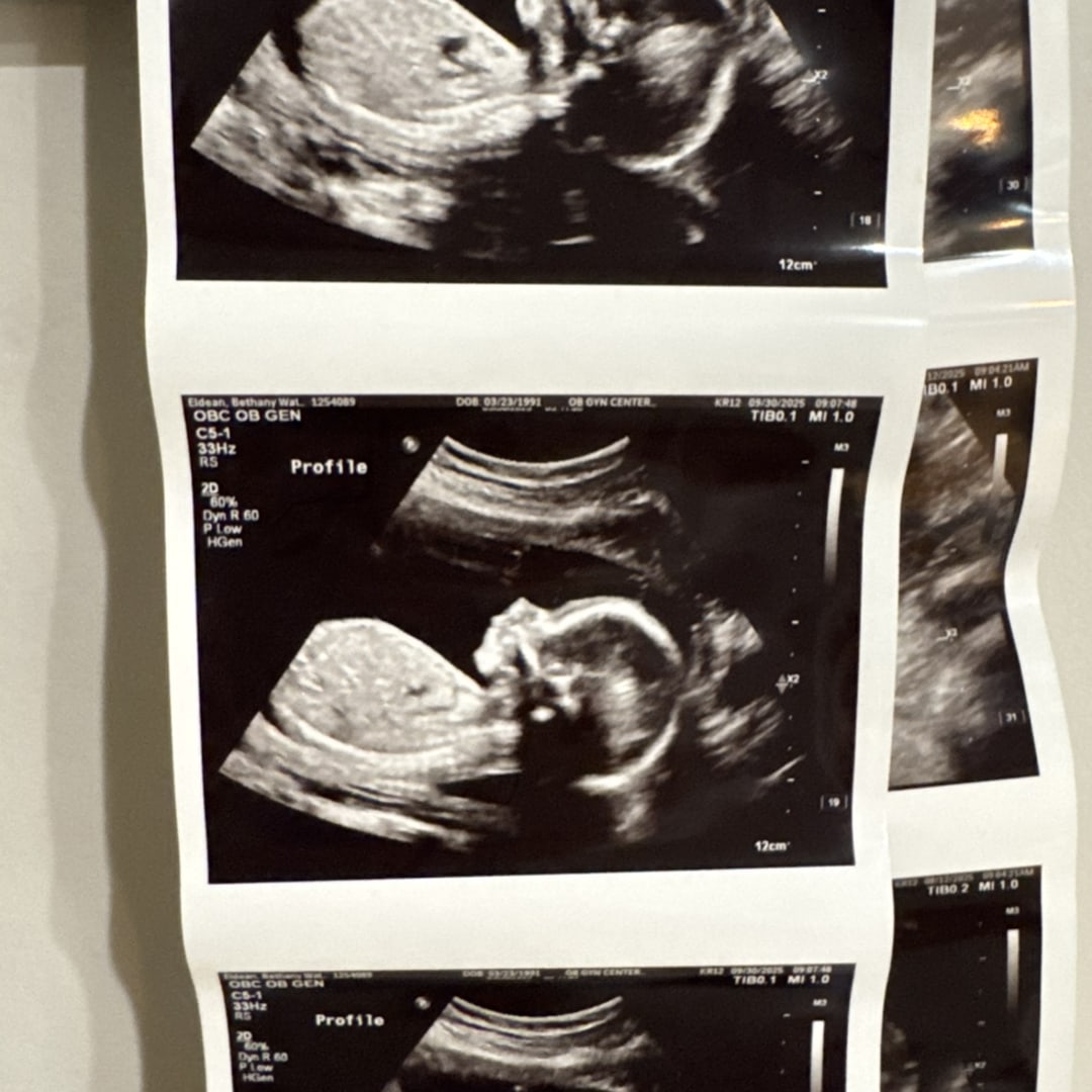 Photo shared by Bethany for their Babylist baby registry.