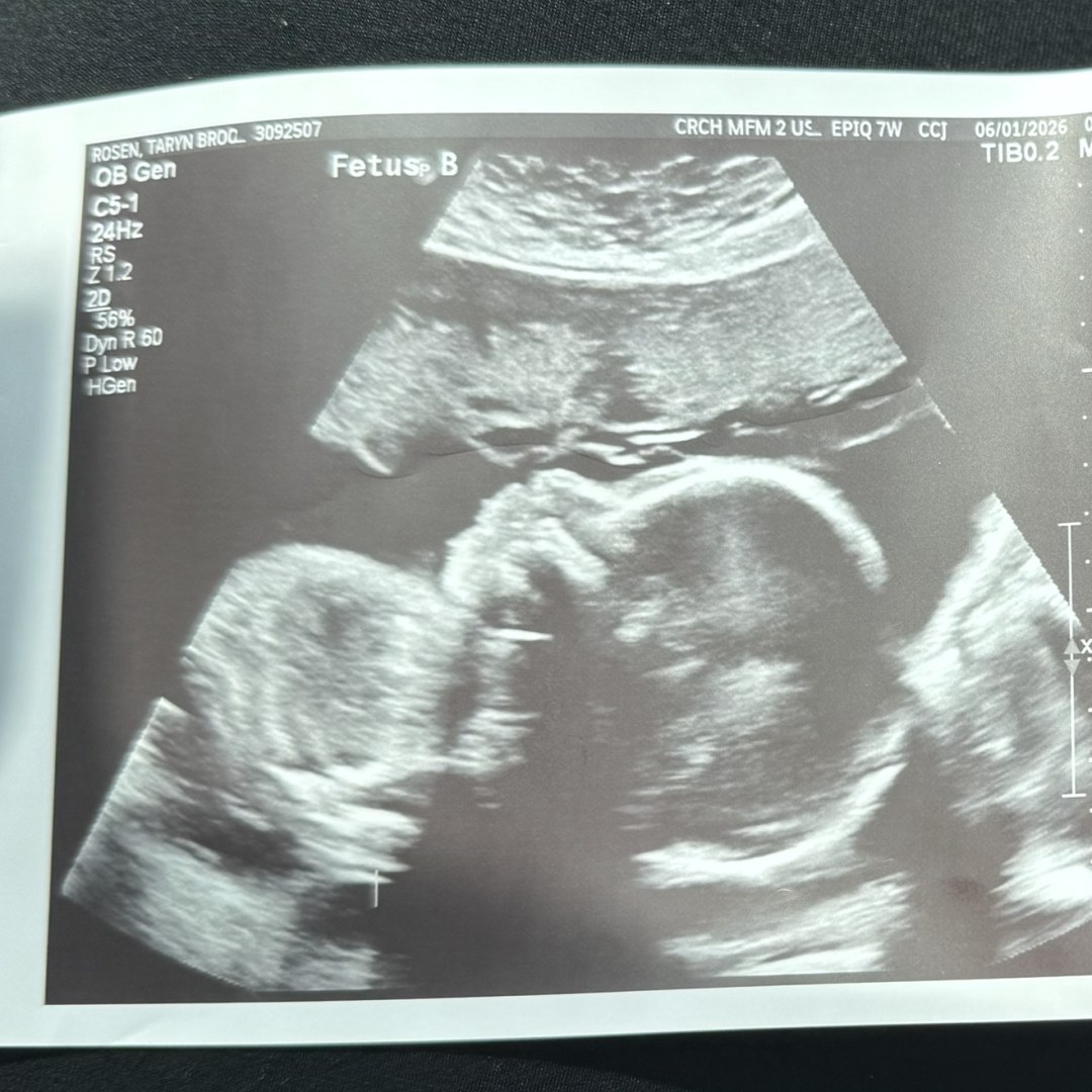 Photo shared by Taryn for their Babylist baby registry.