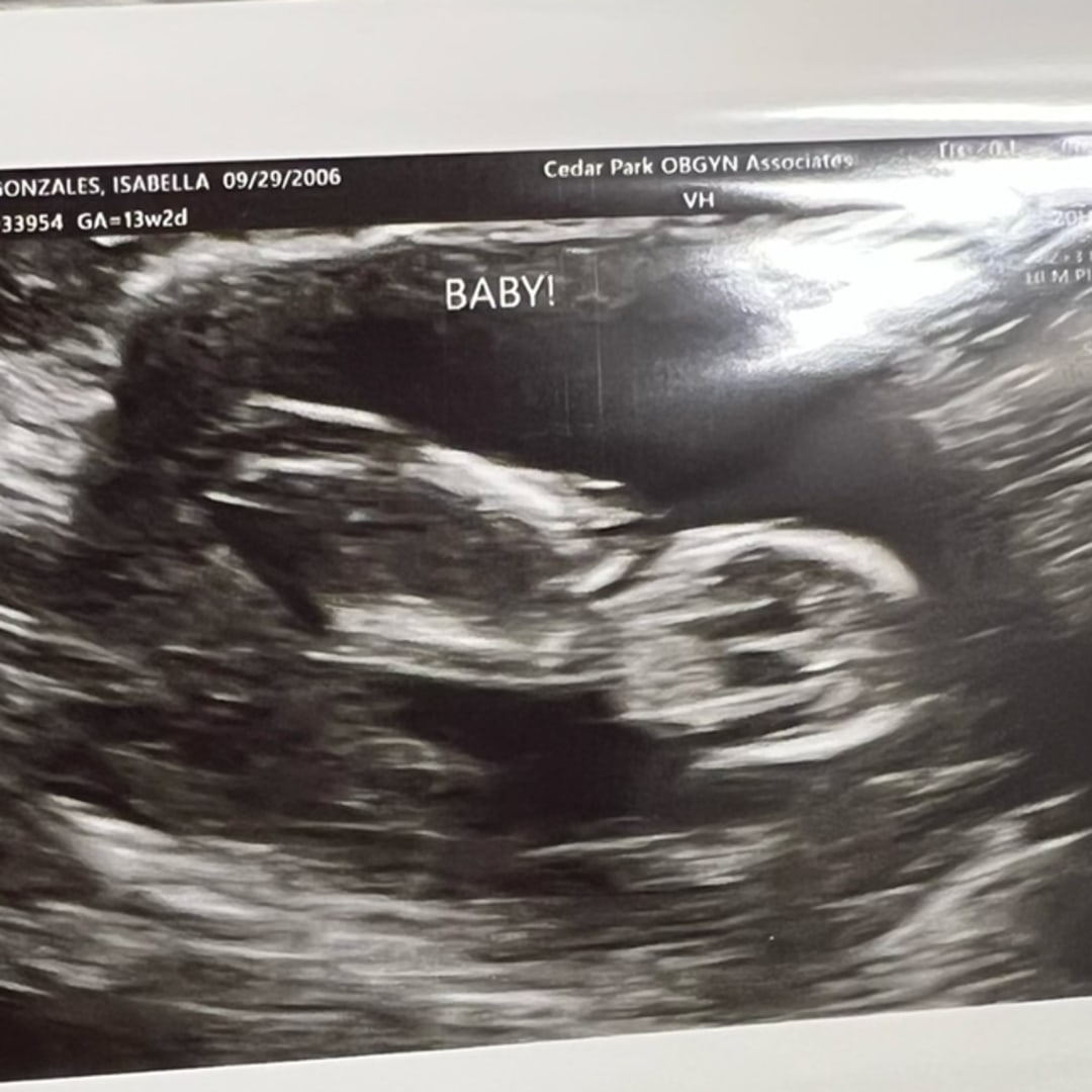 Photo shared by Isabella for their Babylist baby registry.