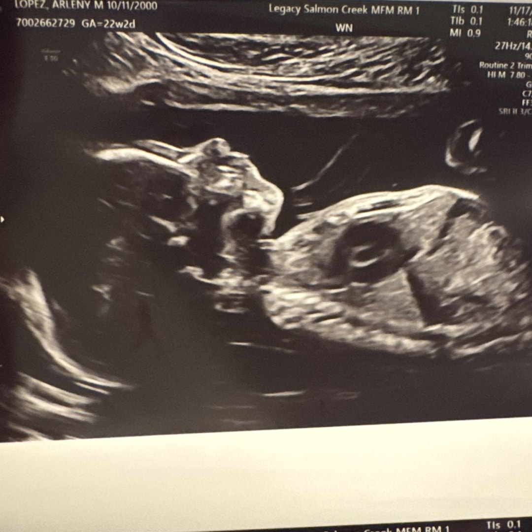 Photo shared by Arleny for their Babylist baby registry.