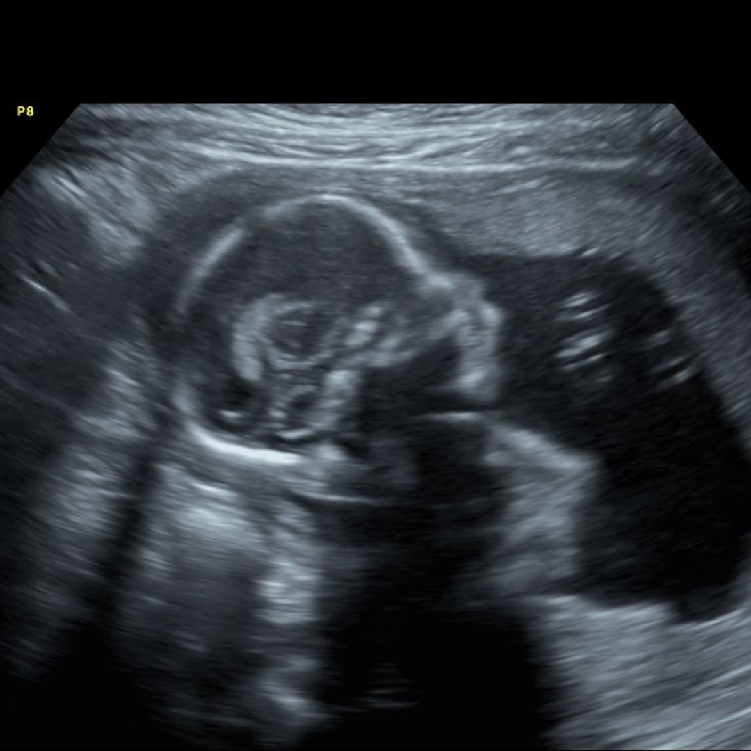 Photo shared by Alayna for their Babylist baby registry.