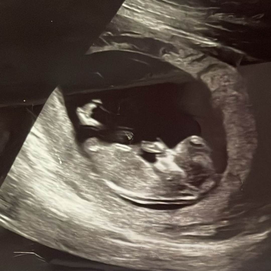 Photo shared by Hans-Claude for their Babylist baby registry.