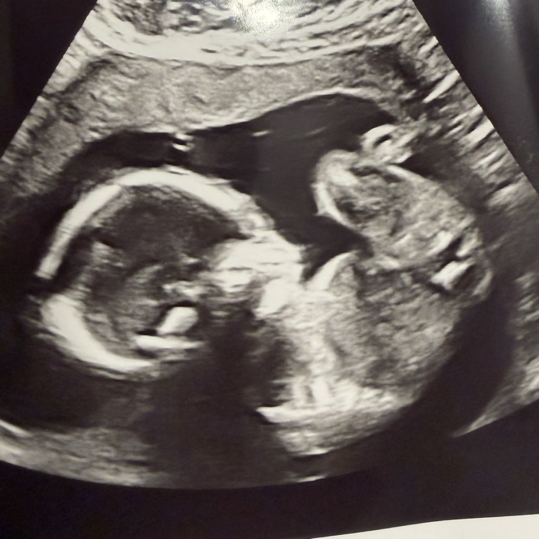 Photo shared by Marissa for their Babylist baby registry.