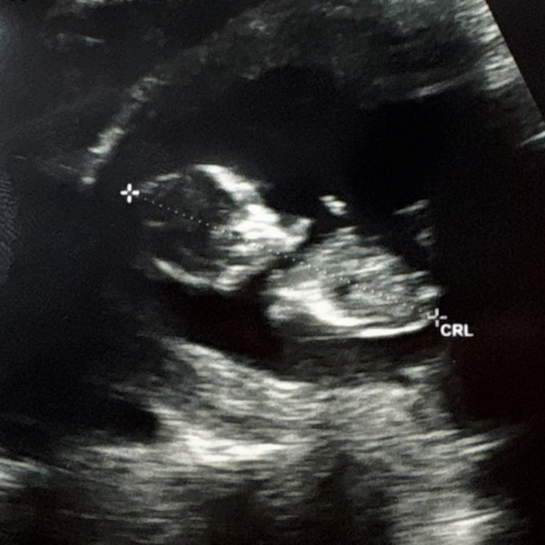 Photo shared by Hannah for their Babylist baby registry.