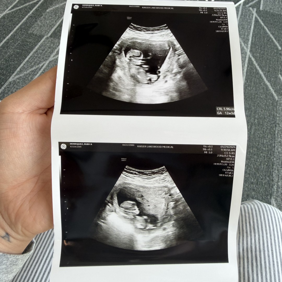 Photo shared by Ruby for their Babylist baby registry.