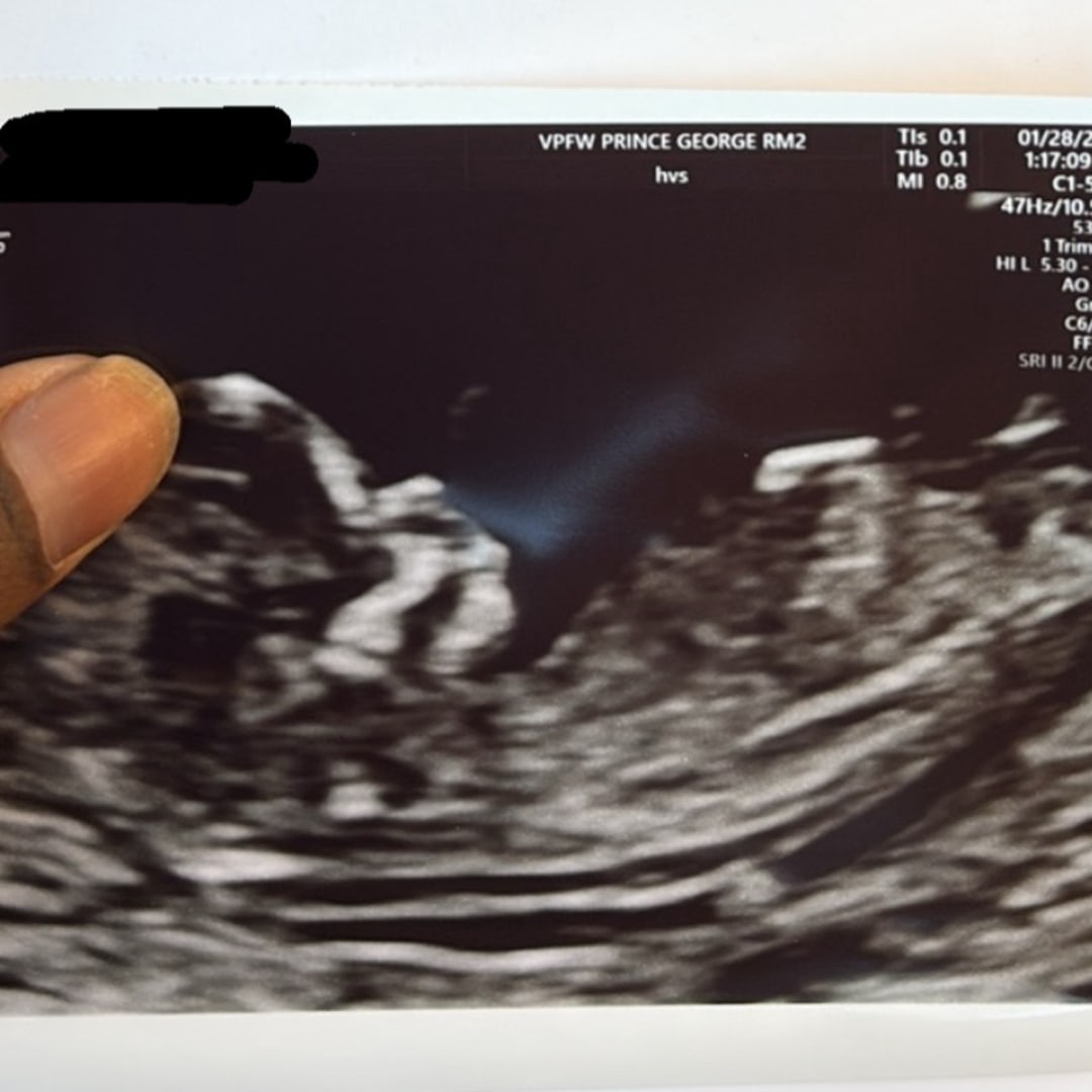 Photo shared by Sonita for their Babylist baby registry.