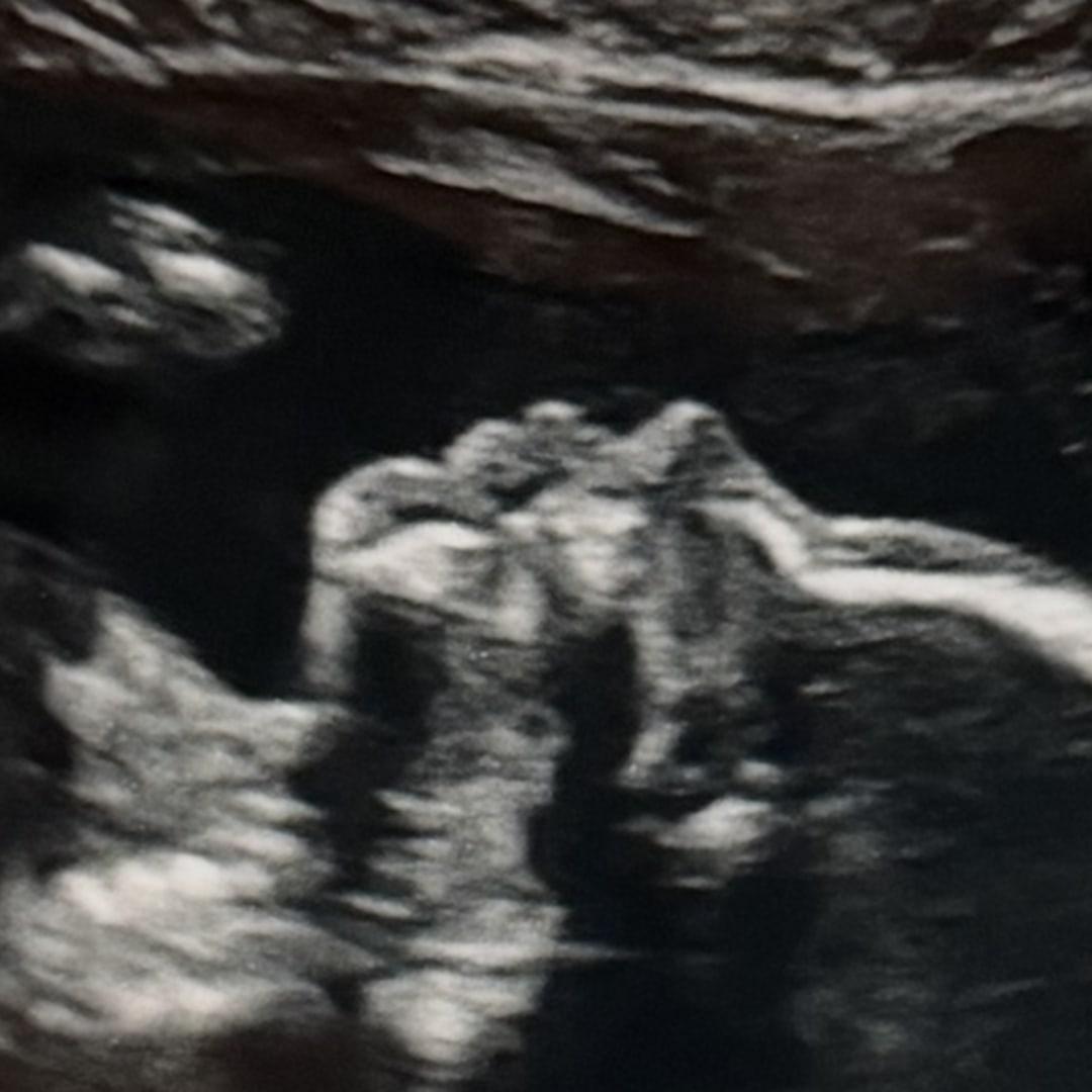 Photo shared by Janelle for their Babylist baby registry.