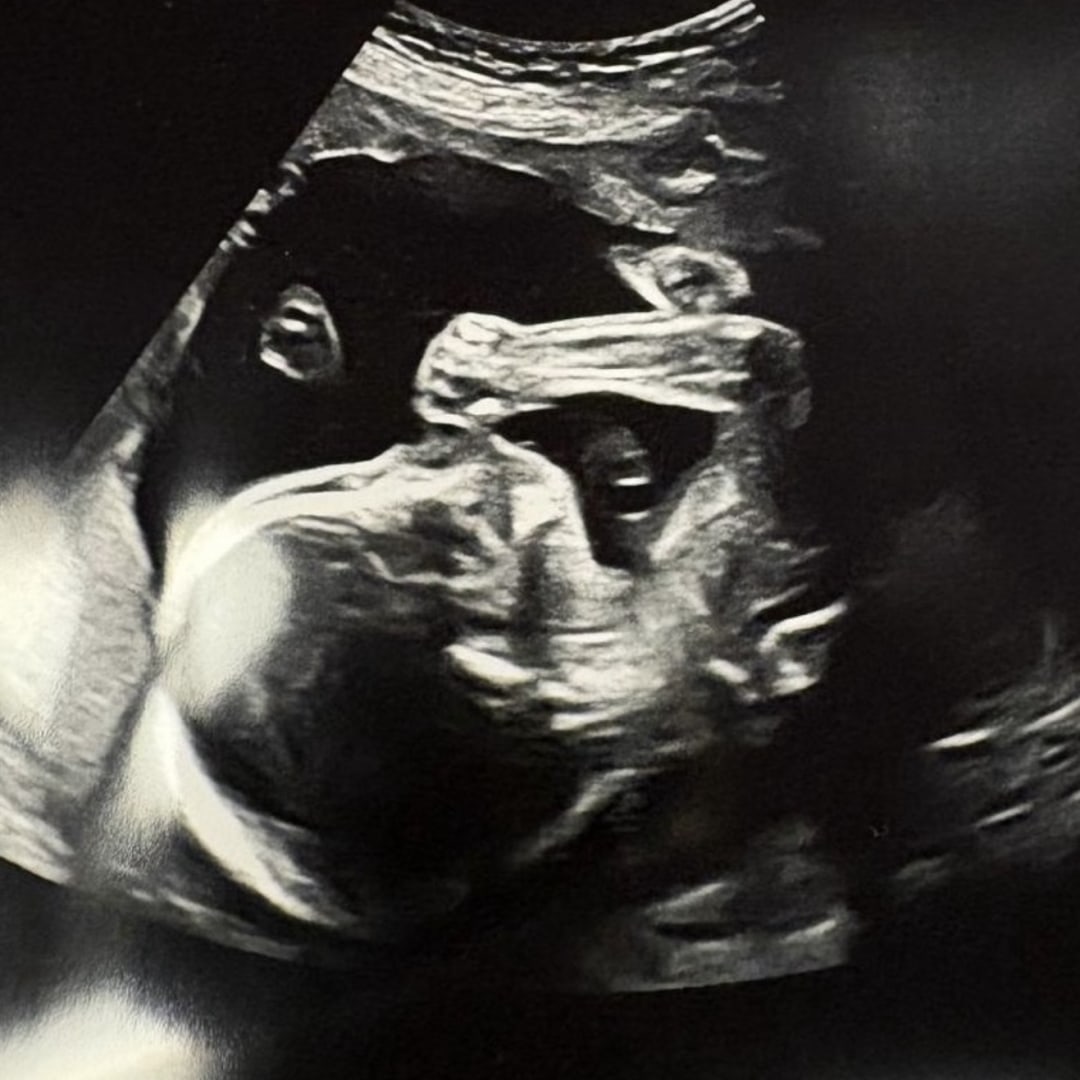 Photo shared by Ella for their Babylist baby registry.