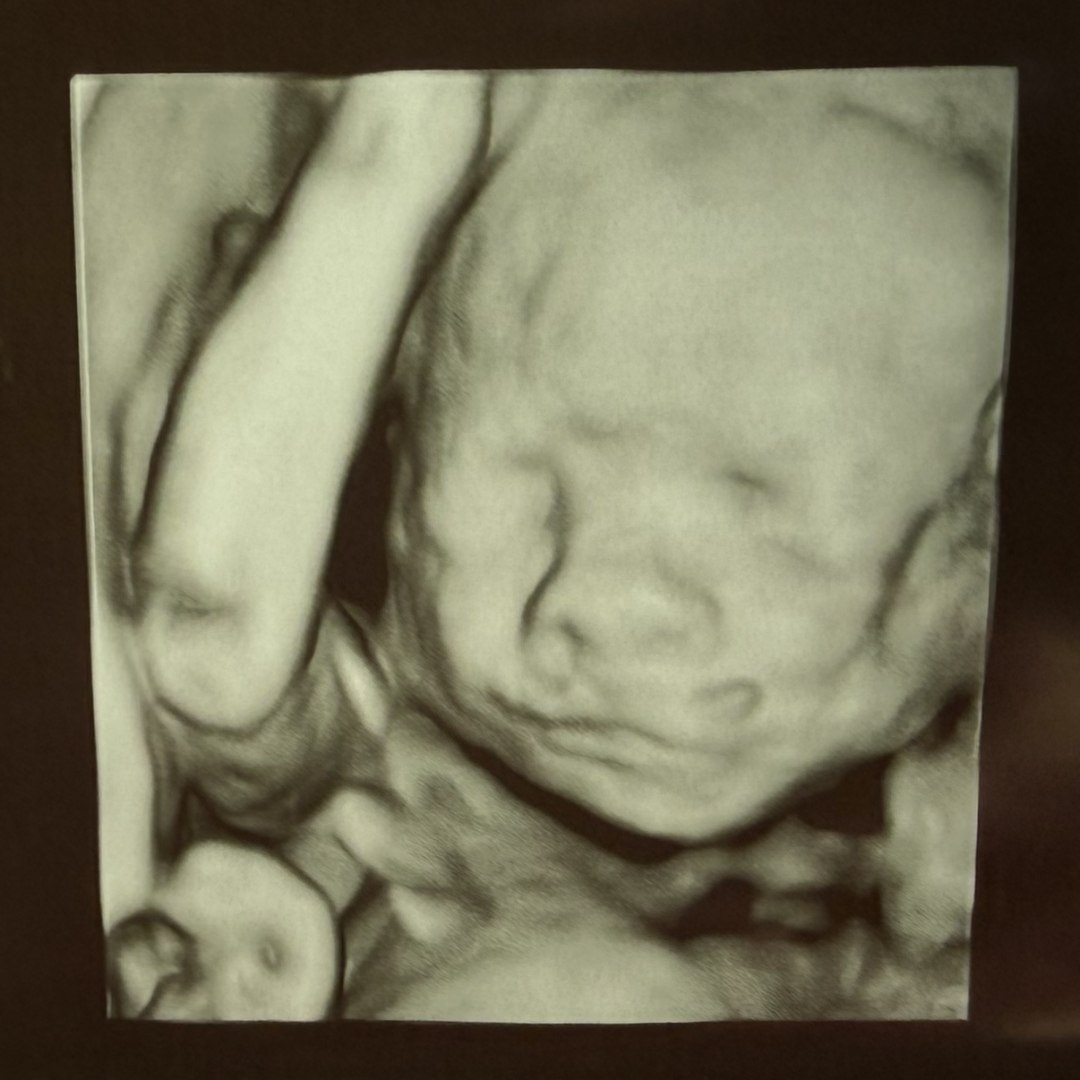 Photo shared by Donna for their Babylist baby registry.