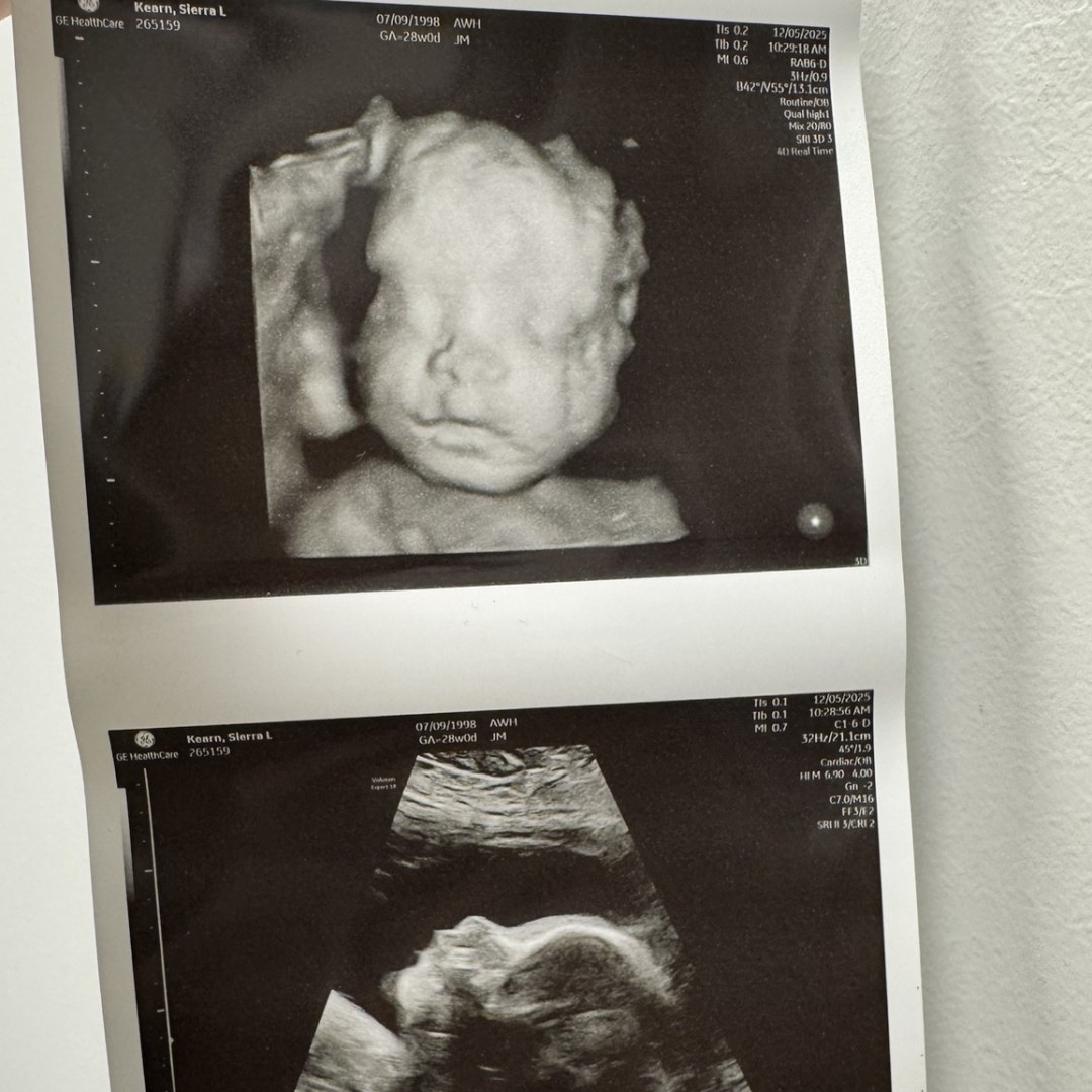 Photo shared by Sierra for their Babylist baby registry.