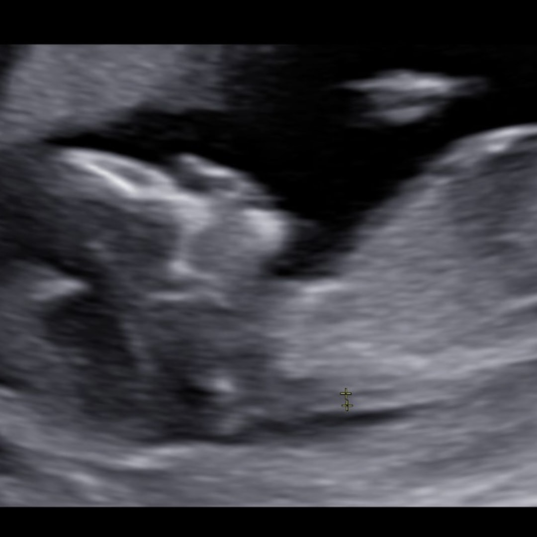 Photo shared by Priscilla for their Babylist baby registry.