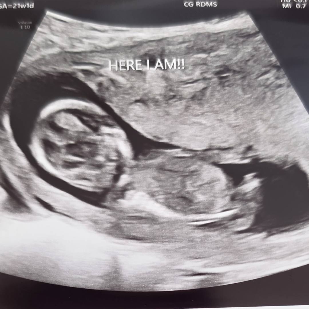 Photo shared by Gabriela for their Babylist baby registry.