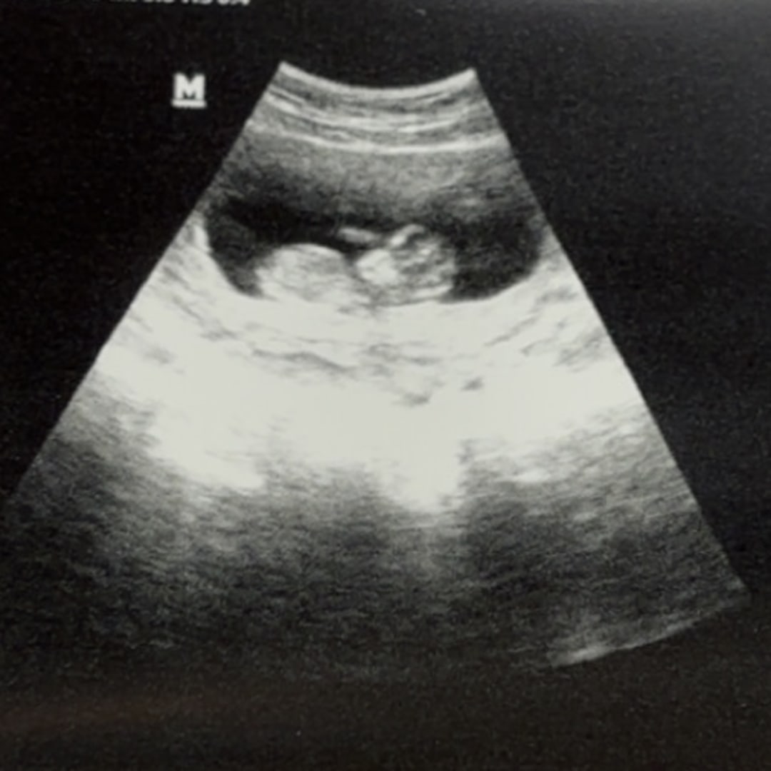 Photo shared by Bree for their Babylist baby registry.