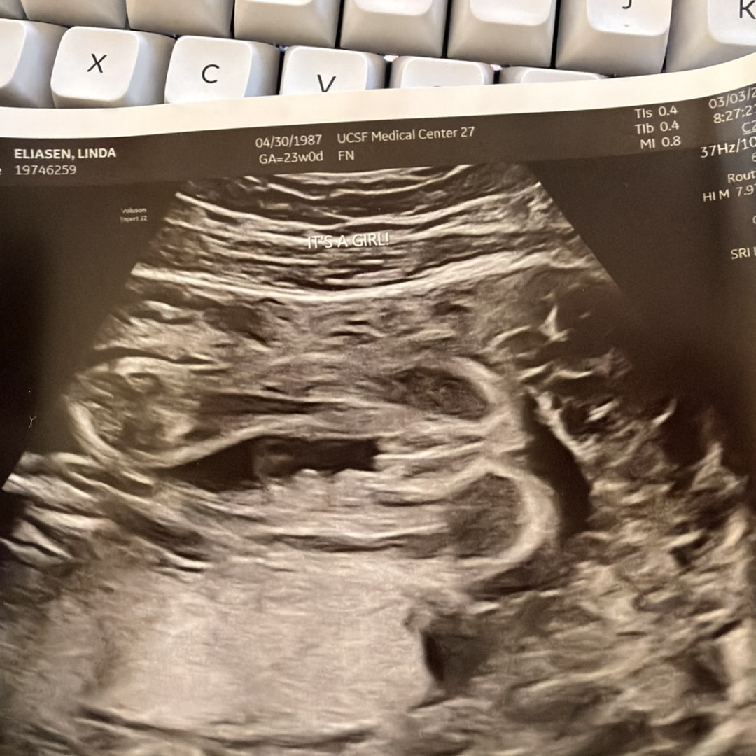 Photo shared by Linda for their Babylist baby registry.