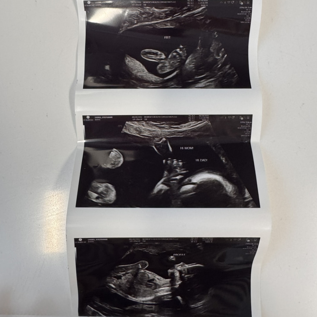 Photo shared by Stephanie for their Babylist baby registry.
