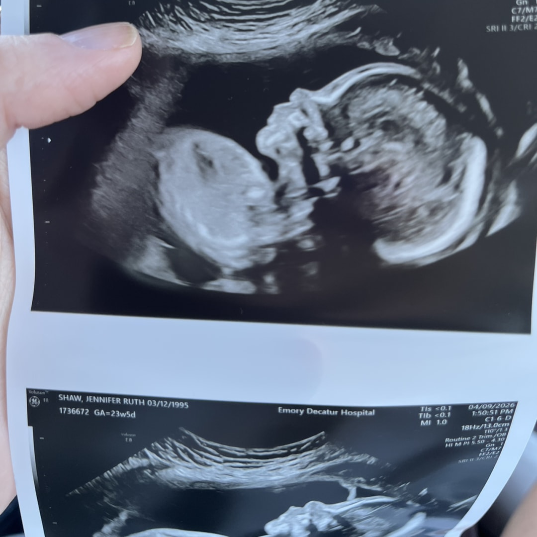 Photo shared by Jennifer for their Babylist baby registry.
