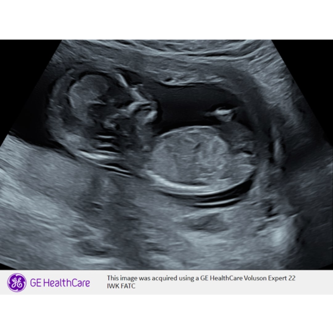 Photo shared by Krista for their Babylist baby registry.