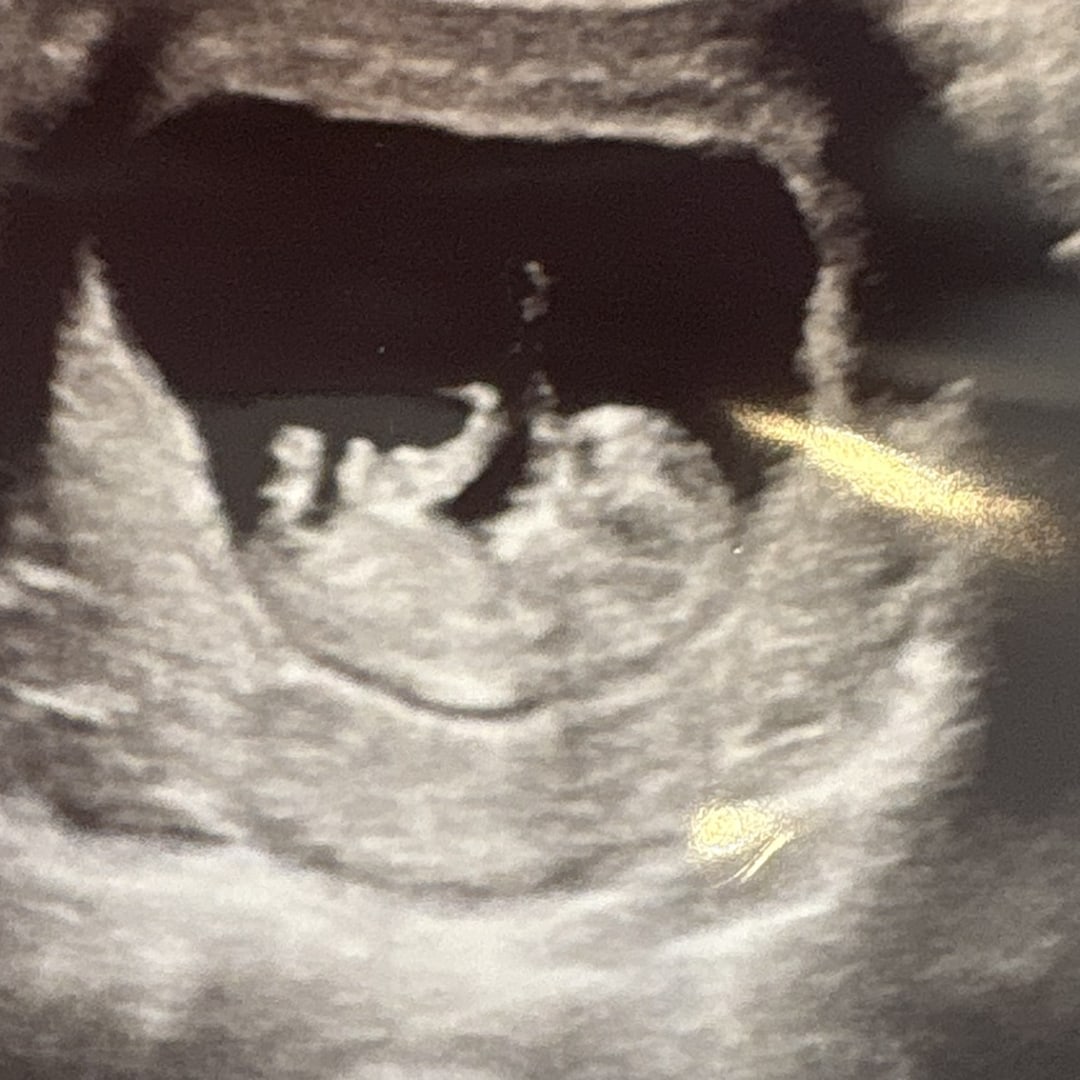 Photo shared by Jamya for their Babylist baby registry.