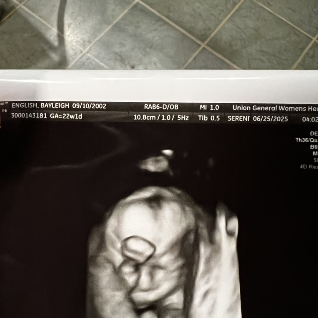 Photo shared by Bayleigh for their Babylist baby registry.
